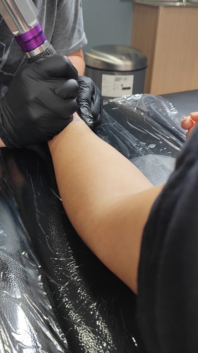 Antebrazo apoyado sobre una camilla cubierta de plástico transparente mientras una mano con guante negro empieza a trabajar con la máquina.